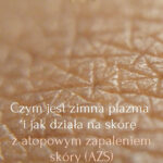Czym jest zimna plazma i jak działa na skórę z atopowym zapaleniem skóry (AZS)