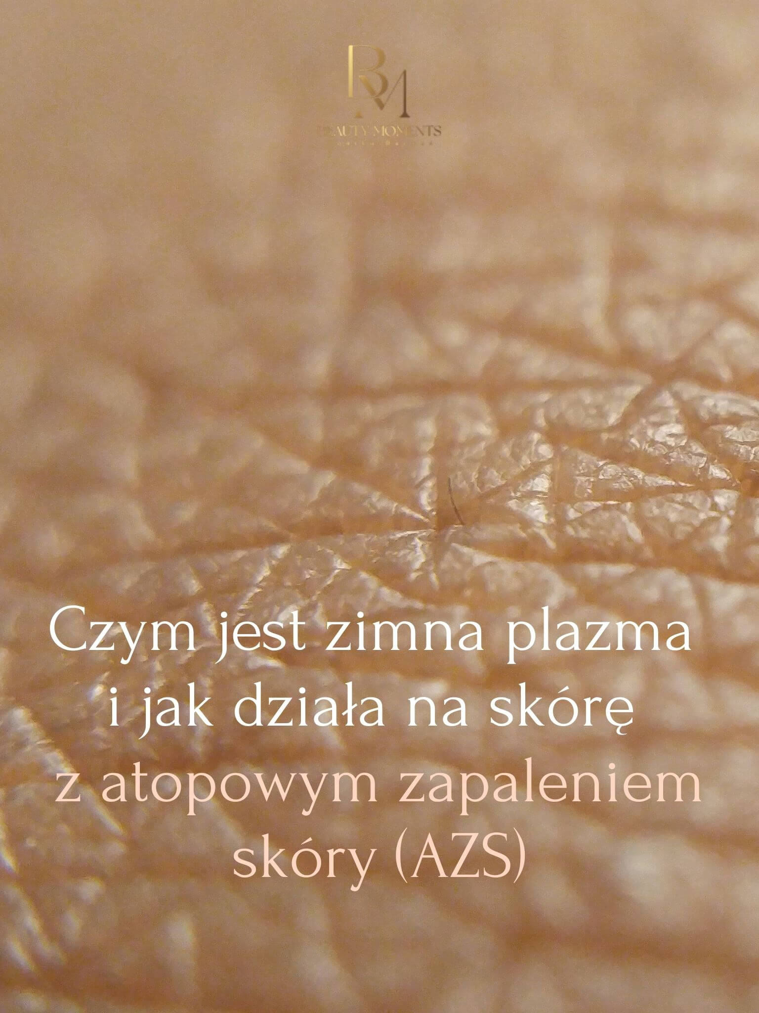 Zimna Plazma Dr Platon (Plasma Shower) 36 Czym jest zimna plazma i jak działa na skórę z atopowym zapaleniem skóry (AZS)