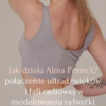 Jak działa Alma PrimeX – połączenie ultradźwięków i fali radiowej w modelowaniu sylwetki