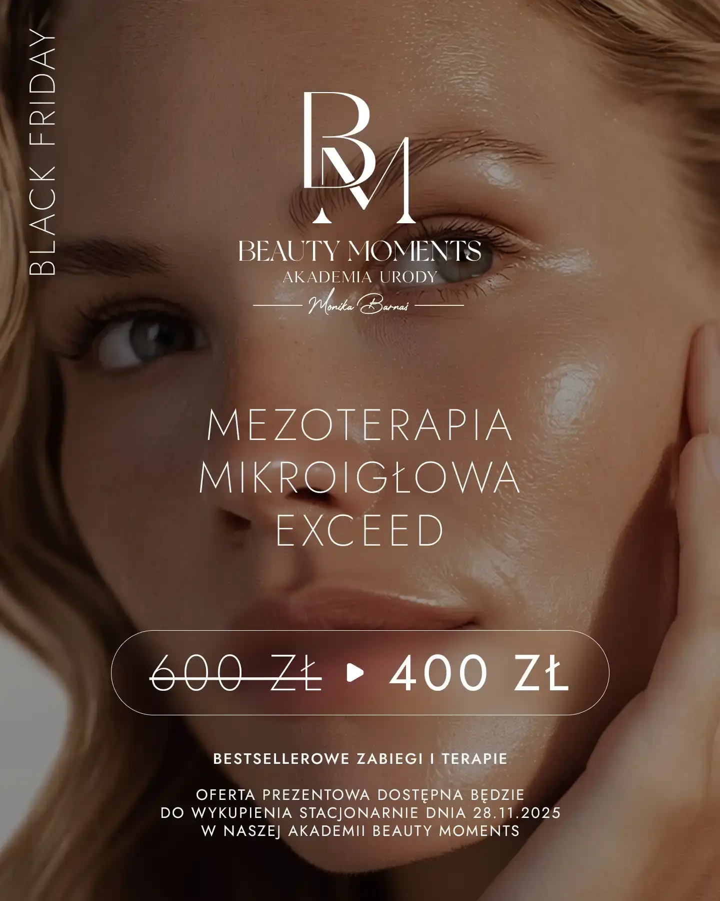 Black Friday 2025 - Zabiegi do 33% taniej!! | Beauty Moments 2 Mezoterapia Mikroigłowa EXCEED - Black Friday