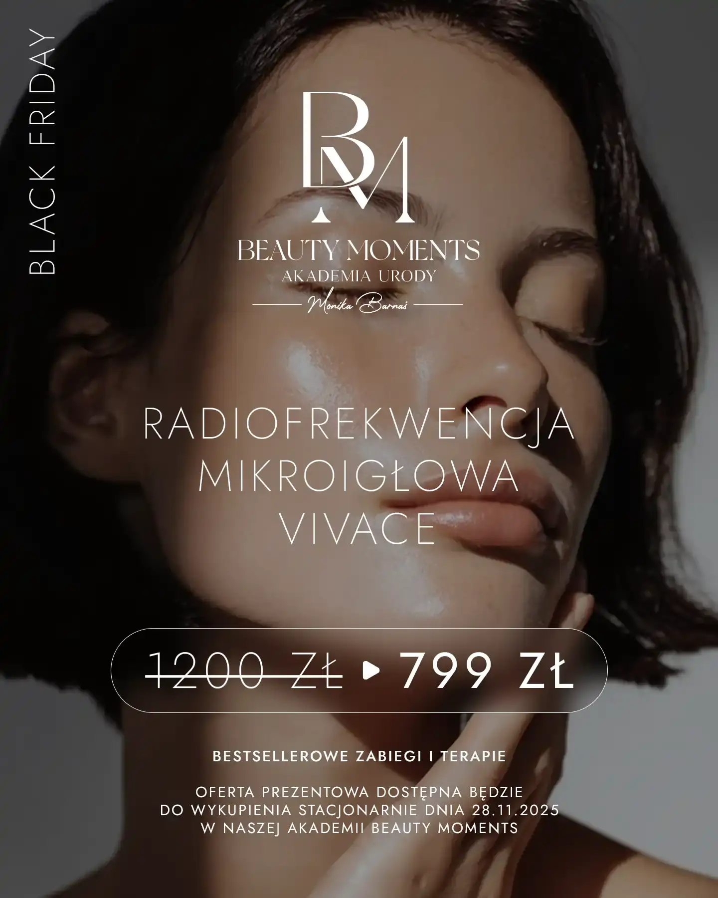 Black Friday 2025 - Zabiegi do 33% taniej!! | Beauty Moments 4 Radiofrekwencja Mikroigłowa Vivace Black Friday