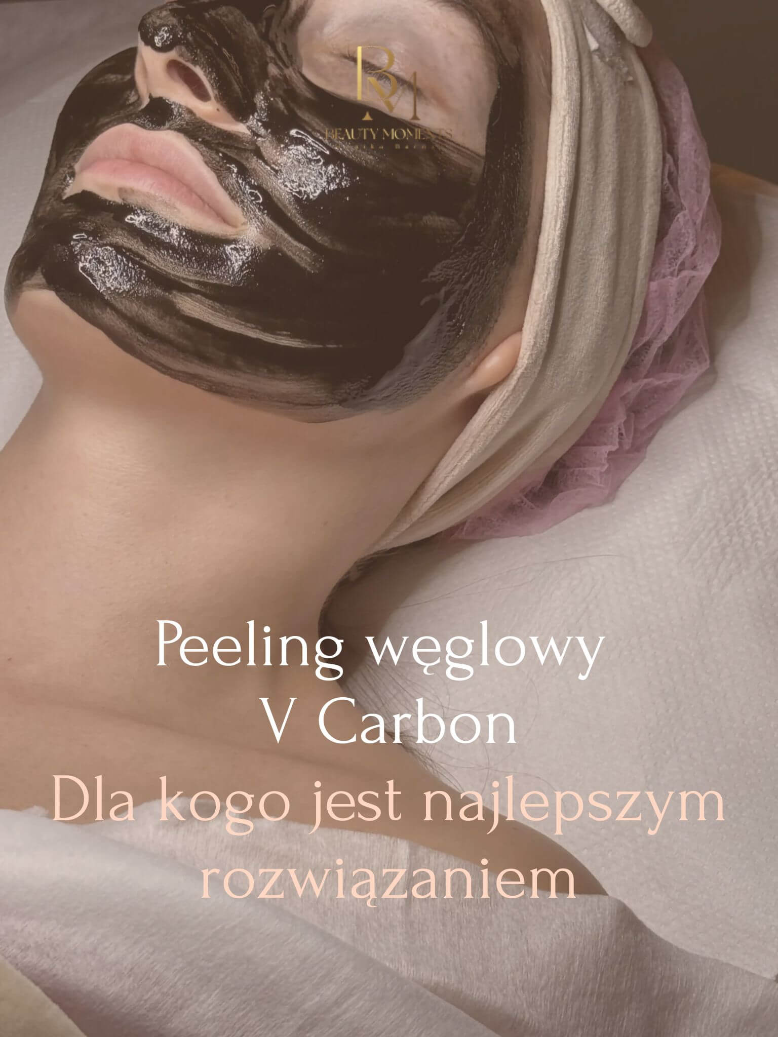 Peeling węglowy V Carbon – dla kogo jest najlepszym rozwiązaniem i jakie daje efekty