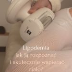 Lipodemia – jak ją rozpoznać i skutecznie wspierać ciało
