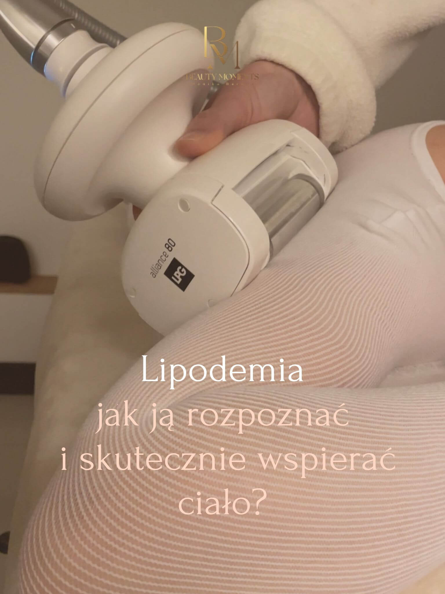 Lipodemia – jak ją rozpoznać i skutecznie wspierać ciało
