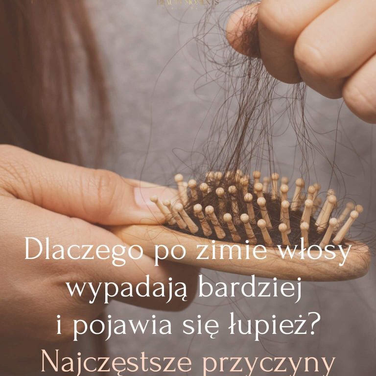 Dlaczego po zimie włosy wypadają bardziej i pojawia się łupież Najczęstsze przyczyny - Wypadanie włosów, Łupież po zimie
