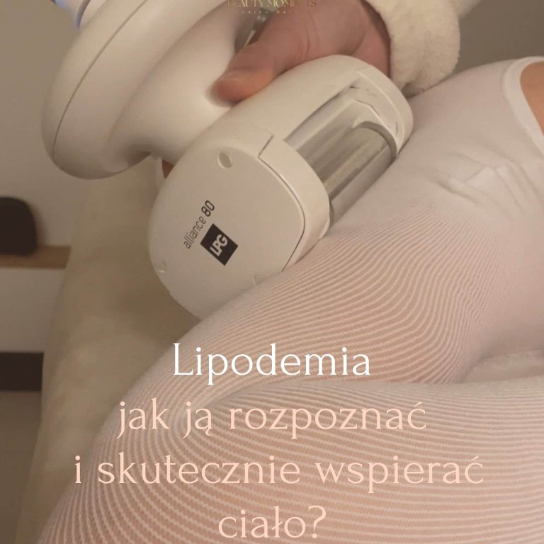 Lipodemia – jak ją rozpoznać i skutecznie wspierać ciało