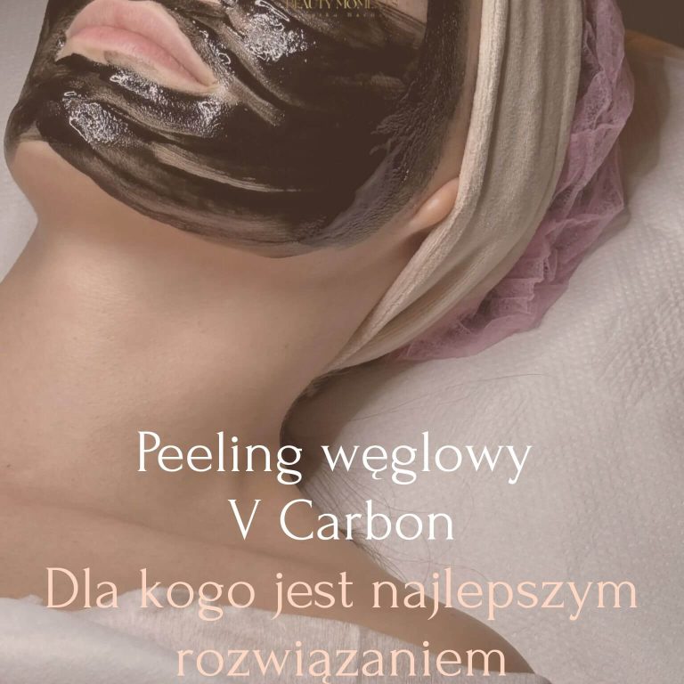 Peeling węglowy V Carbon – dla kogo jest najlepszym rozwiązaniem i jakie daje efekty